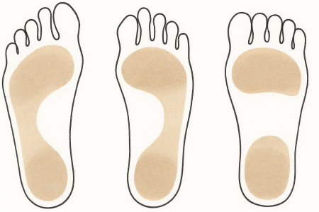 Three footprint silhouettes showing big toe longest, second toe longest, and first three toes equal
