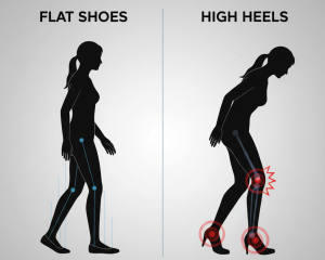 Line art comparison: Balanced flat-heel walker vs. tilted high-heel figure with red stress markers on knees and toes.