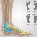 anatomical illustration of human foot showing all four arches in glowing colors with sustentaculum tali labeled