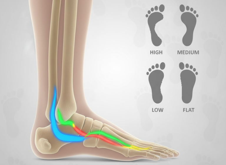 anatomical illustration of human foot showing all four arches in glowing colors with sustentaculum tali labeled
