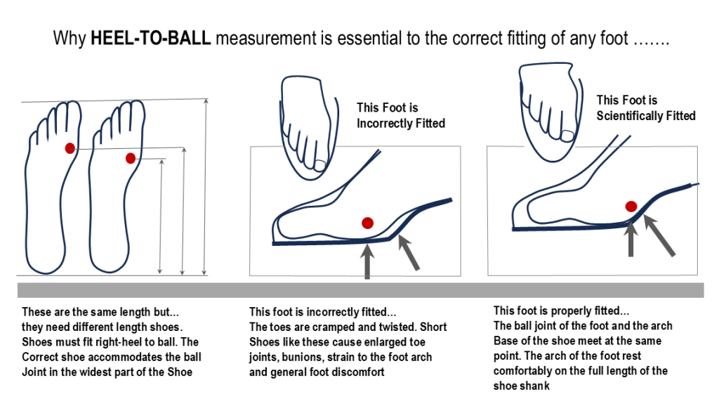 Heel-to-ball mismatch consequences